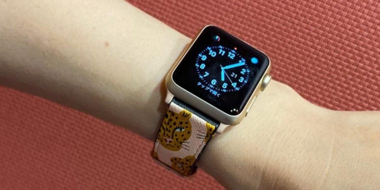 CASETiFY Apple Watch バンド